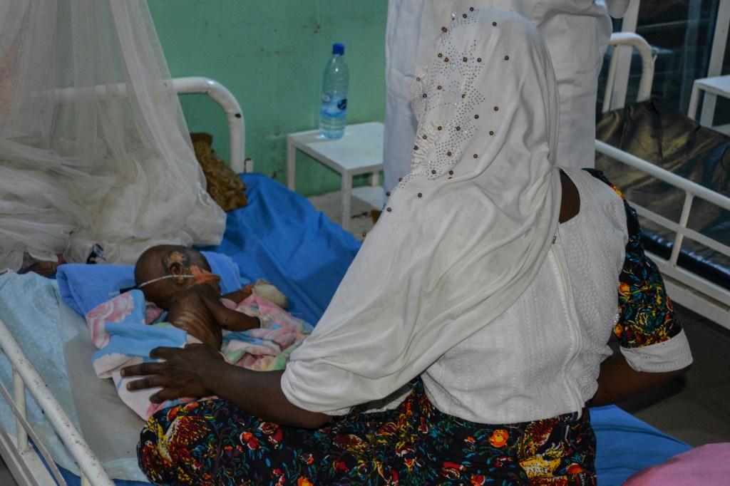 A growing number of children are suffering from malnutrition in Chad | AFP