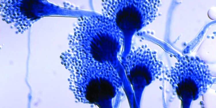 Fungal pathogens of humans, animals and plants. 
Photo: NCBI