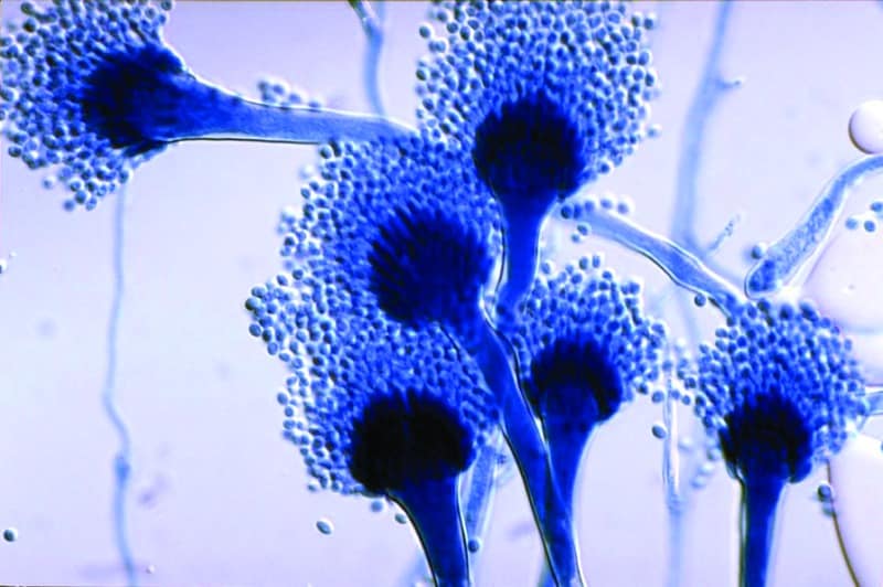 Fungal pathogens of humans, animals and plants. 
Photo: NCBI