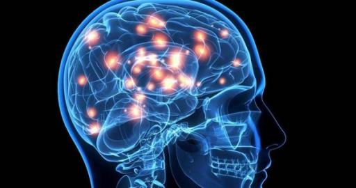 Concentration of Cannabis in the brain. 
Photo: Courtesy