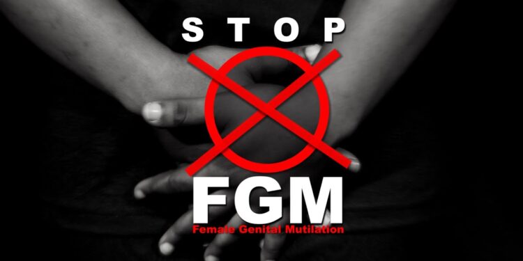 FGM