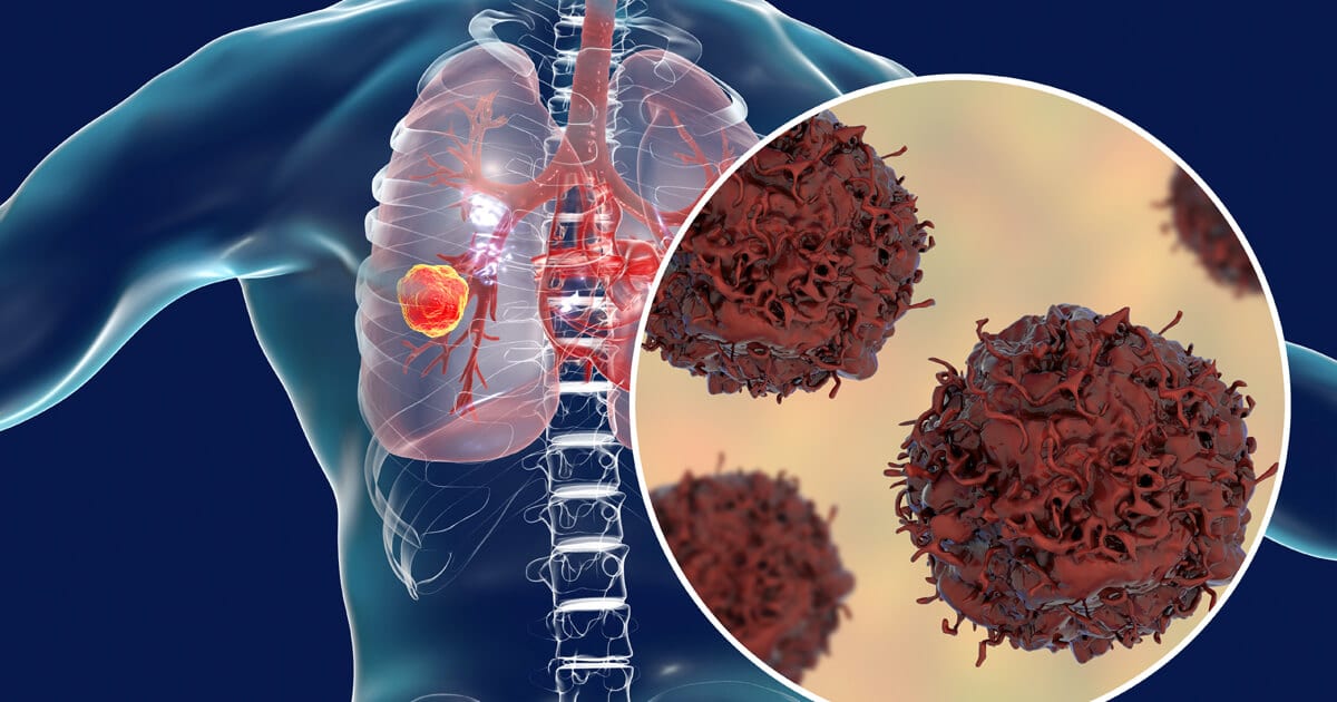 Image: Pfizer