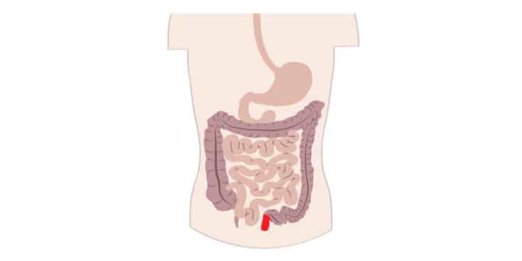 Decoding Crohn's Disease

Photo Courtesy