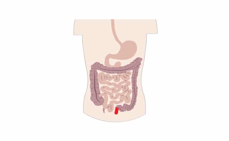 Decoding Crohn's Disease

Photo Courtesy
