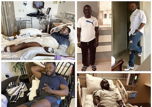 Moses Gibson, the Man who Underwent Leg Surgery to Increase his Height: PHOTO/Courtesy