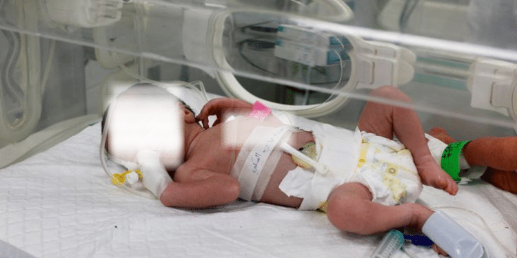 Gaza Infant Succumbs Days After Being Rescued