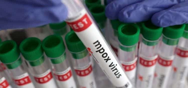 Mpox: First Batch of Vaccines Arrive Set to Arrive in Africa