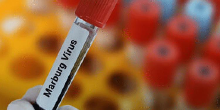 Ministry of Health Issues Marburg Alert
