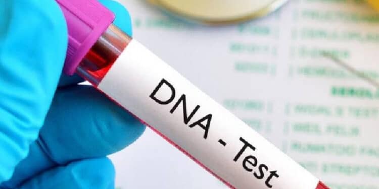 DNA Test Kit.PHOTO/File. KEMRI