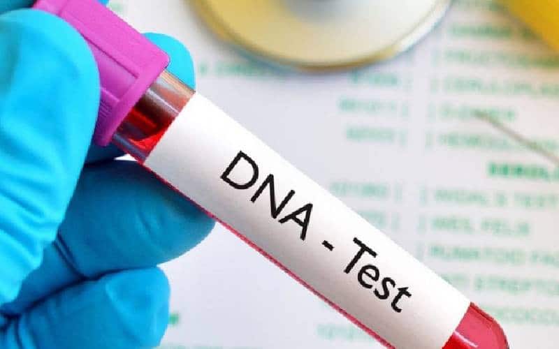 DNA Test Kit.PHOTO/File. KEMRI