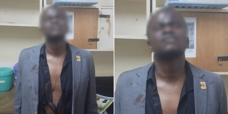 Cleophas Malala Driver after being assaulted