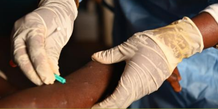 A nurse taking a sample from a child declared a suspected case of Mpox PHOTO/Nation