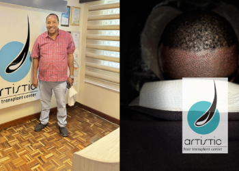 A Photo Collage Of Former Kiambu Governor Ferdinand Waititu With Jared Babu At The Artistic Hair Transplant Center And A Logo Of The Facility. Photo/Artistic Hair Transplant Center.