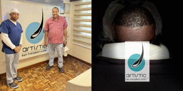 A Photo Collage Of Former Kiambu Governor Ferdinand Waititu With Jared Babu At The Artistic Hair Transplant Center And A Logo Of The Facility. Photo/Artistic Hair Transplant Center.